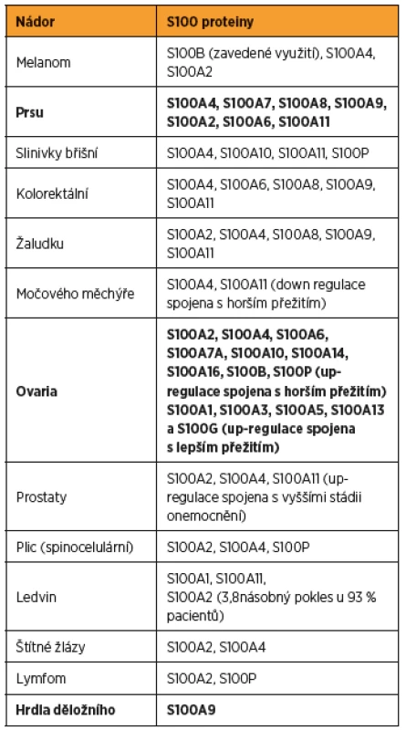 Shrnutí asociací, které byly zaznamenány mezi různými
typy nádorů a proteiny S100, v tabulce jsou zvýrazněny tumory
prsu, ovaria a děložního hrdla