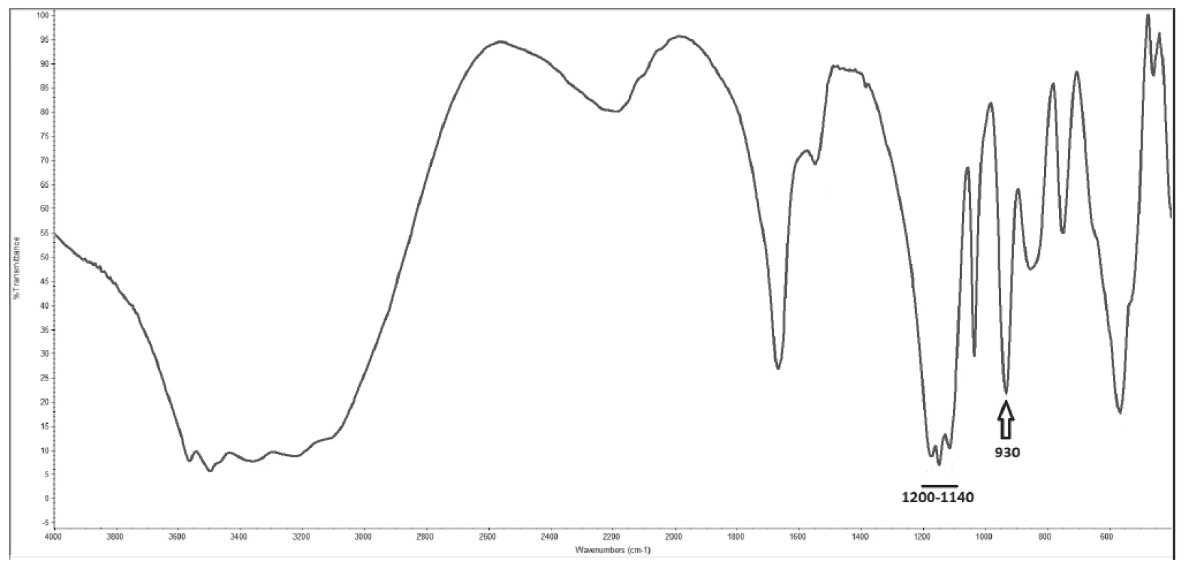 Infra-red spectrometry spectrum of analysed renal
stone with specific peak for pyrophosphate (930 cm-1) and
specific region for sulphates (1200 - 1140 cm-1)