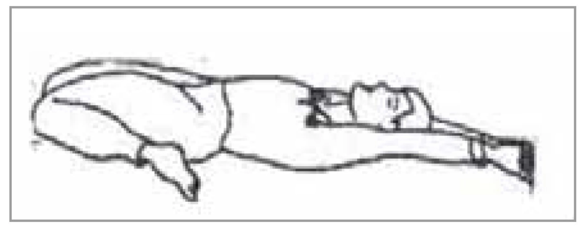 Cvik pre meridián sleziny<br>
Fig. 8. Exercise for the spleen meridian