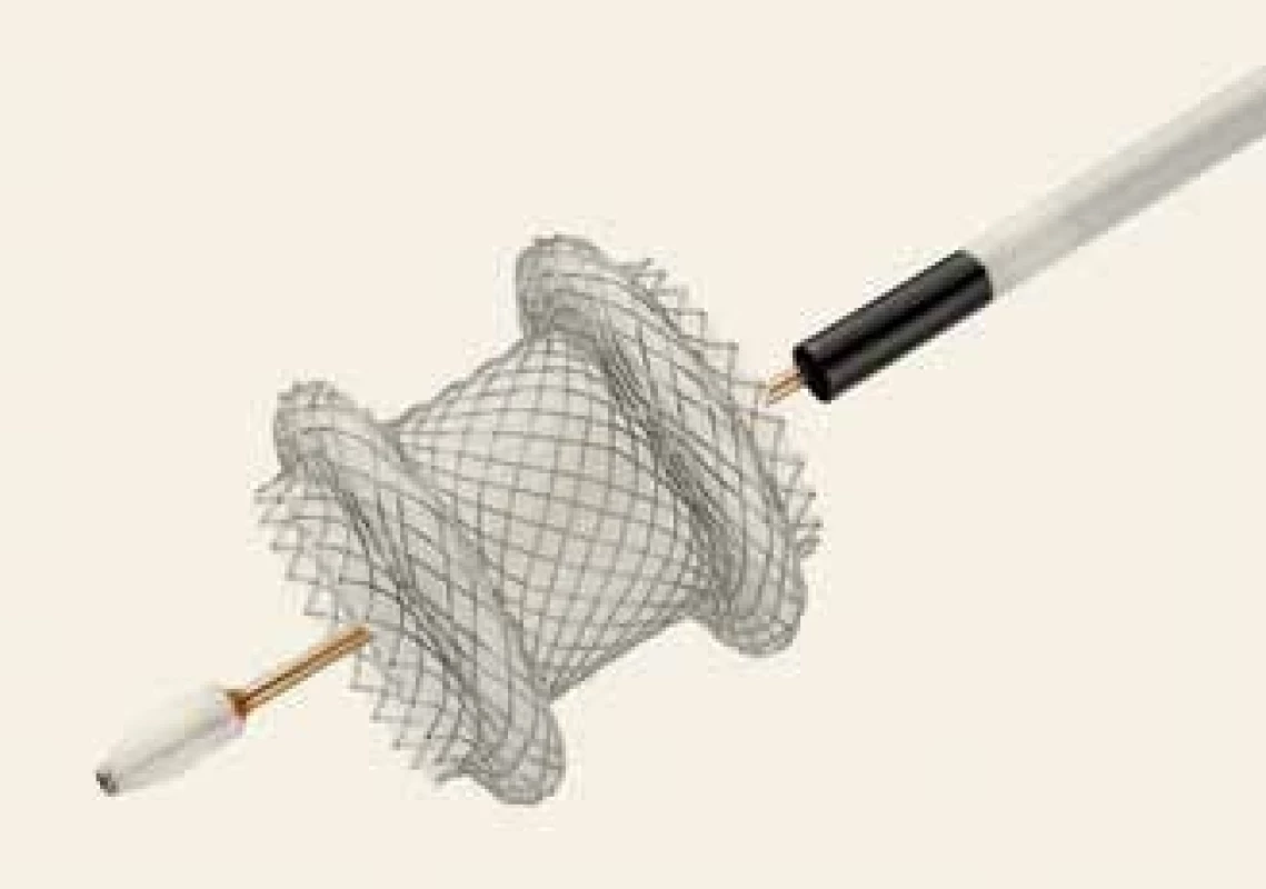 Metalický apoziční stent Hot AXIOS.<br>
Fig. 1. A lumen apposing metal stent
Hot AXIOS.