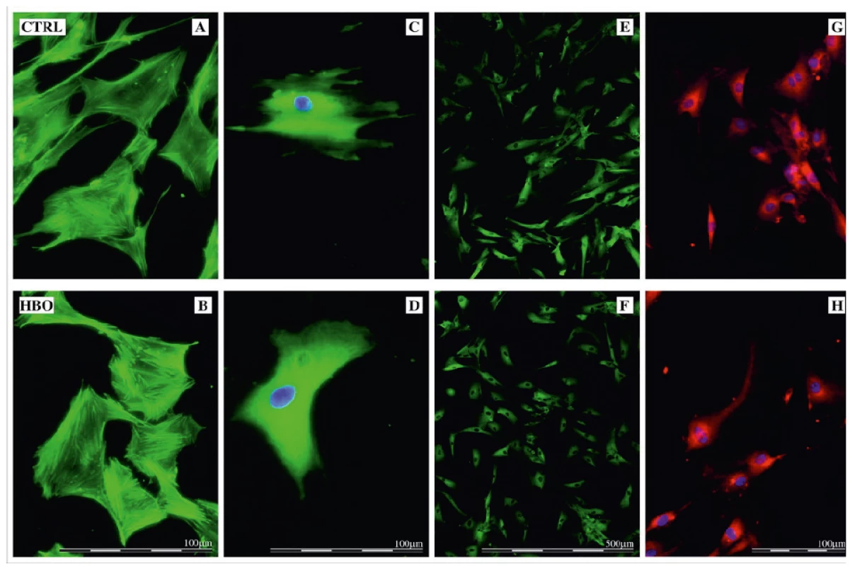 A-H. Fluorescenční mikroskopické snímky lidských fibroblastů
HFL1 (CTRL A, C, E, G), (HBO, B, D, F, H)<br>
Vizualizace fokálních adhezí a cytoskeletu (A-F): aktinová vlákna (A,
B, zvětšení 200krát), vimentin (C, D, zvětšení 200krát), vinculin (E, F;
zvětšení 40krát). Buňky měly normální mezenchymální morfologii bez
viditelných rozdílů. Kvalitativní analýza mitochondrií při zvětšení 160krát
(G, H) neprokázala žádné zjevné změny v množství a lokalizaci organel
nebo v struktuře mitochondriálních sítí.