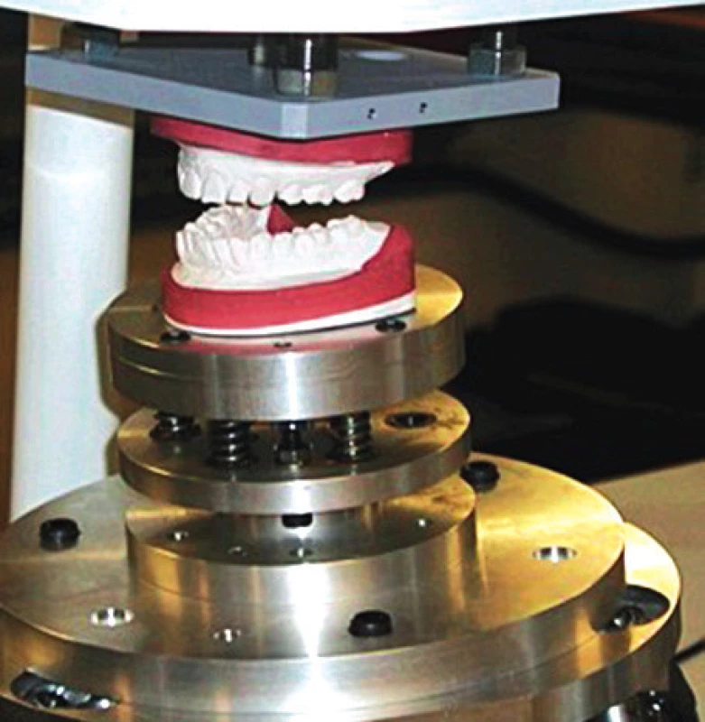 Simulátor čelistí (artikulačního pohybu) [http://www.bristol.
ac.uk/dental/news/2011/54.html]