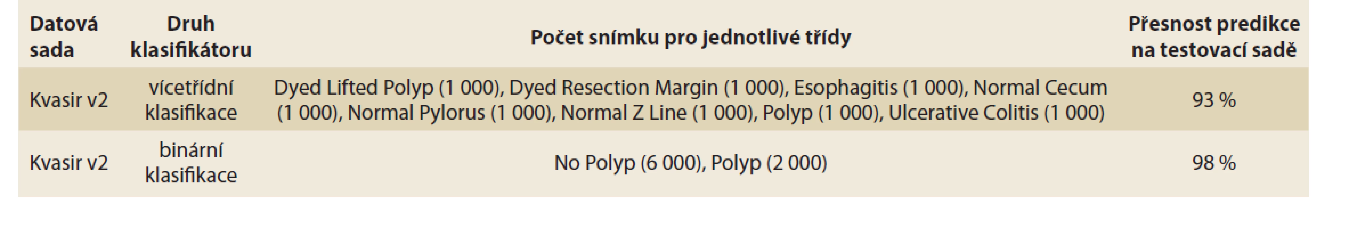 Prediktivní přesnost neuronové sítě ResNet-50 pro jednotlivé datasety.<br>
Tab. 1. Predictive accuracy of the ResNet-50 neural network for individual datasets.