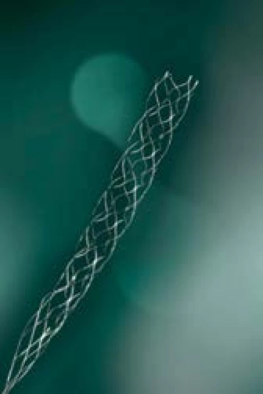 Stent-retriever Catch