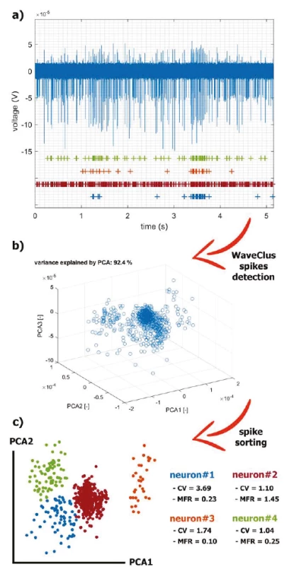 The application of the selected methods for real
MER processing. The recorded series is a summary
activity of a large number of neurons further away from
the electrode (background activity) and the activity of
neurons in close vicinity of the electrode tip (single-unit
activity). The signal can be decomposed in an estimation
process called spike-sorting: a) A filtered raw signal
and visualization of individual spike trains hidden in it.
b) We used PCA to reduce multidimensional space after
WaveClus detection. c) The spikes were sorted by the 4-
means method and characteristic statistics on extracted
neurons are listed.