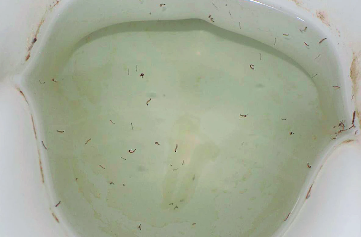 Živé larvy C. albipunctata v záchodové míse (archiv
pacienta)<br>
Figure 3. Live larvae of C. albipunctata in the toilet bowl
(patient’s archive)