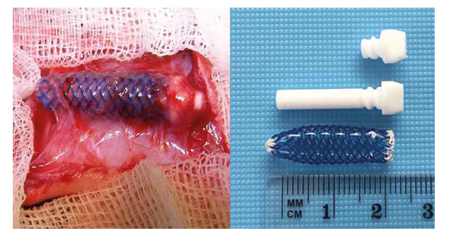 Silonová komůrka používaná k transplantaci Langerhansových ostrůvků do podkoží a do omenta na zvířecím
modelu [34]<br>
Fig. 1: Silon pouch used for pancreatic islet transplantion in the subcutaneous space and in the omentum in an
animal model [34]