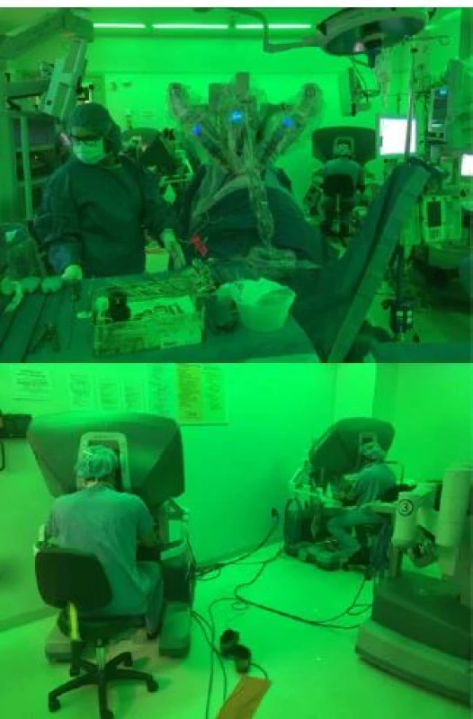 Robotická pyeloplastika u tříměsíčního kojence<br>
Fig. 3. Robotoc pyeloplasty in 3 month old infant