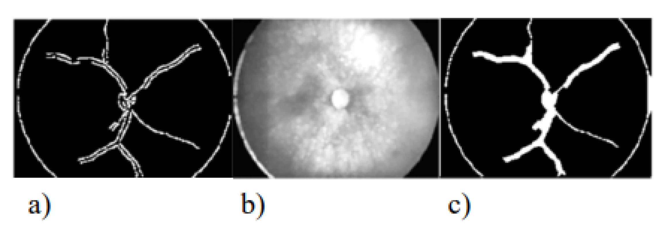 Individual process of image segmentation for
extraction of blood vessels: a) Canny Edge Detection
(threshold: 0.3), b) Dilatation (structural element:
diamond, radius: 4), c) Close (structural element:
Diamond, radius: 11)