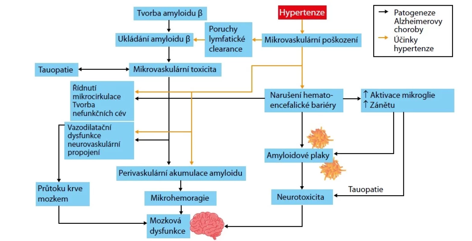 Hypertenze akceleruje Alzheimerovu chorobu (17)
