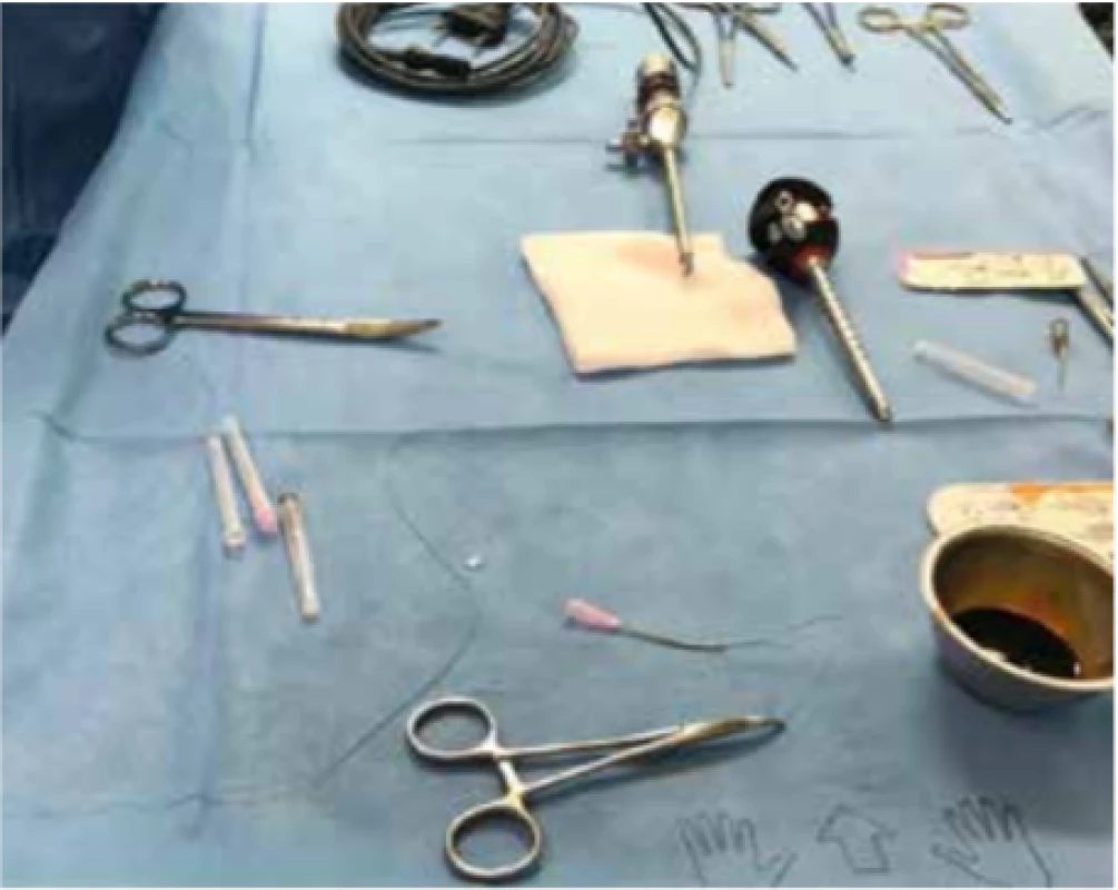 Instrumentárium<br>
Fig. 1: Instruments for PIRS