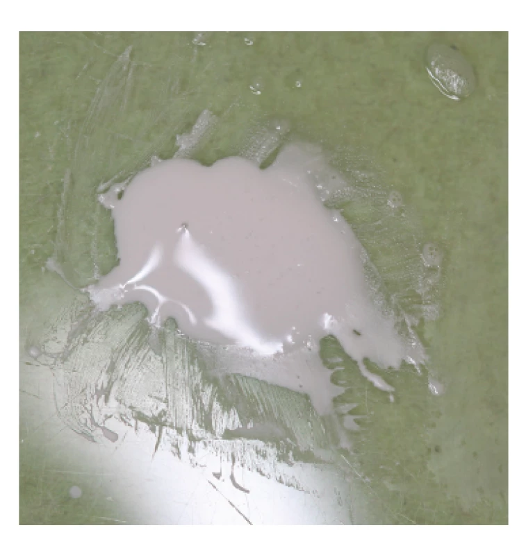 Čerstvo namiešaný<br>
biokeramický sealer<br>
BioRoot™ RCS<br>
Fig. 3<br>
Freshly mixed<br>
bioceramic sealer<br>
BioRoot™ RCS