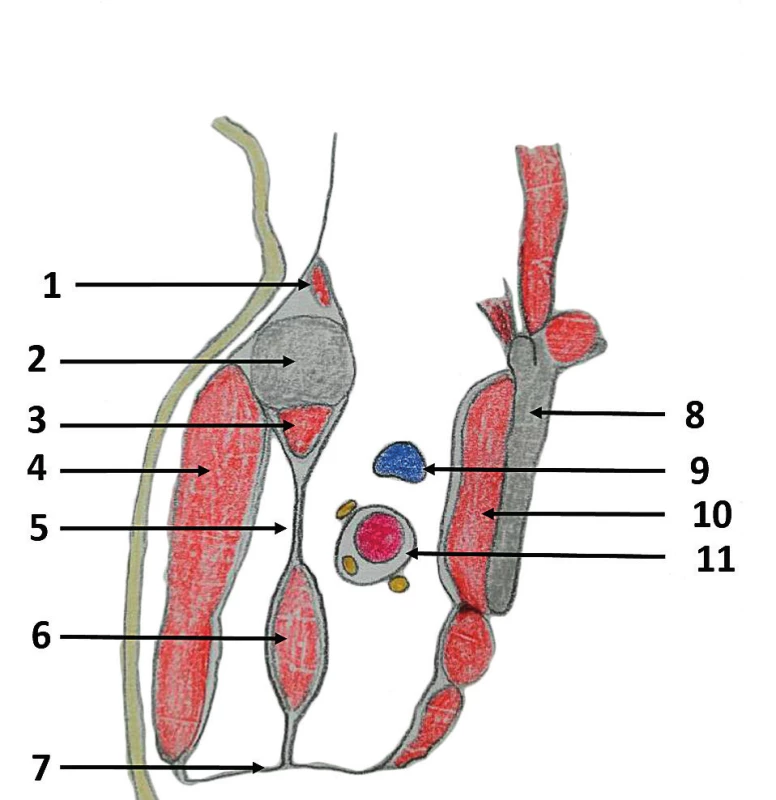Horizontální řez axilou<br>
1 – žebro, 2 – m. serratus ant., 3 – m. subscapularis, 4 – lopatka,<br>
5 – humerus, 6 – m. psoas major, 7 – m. psoas minor,<br>
8 – společná pochva axilární arterie a brachiálního plexu