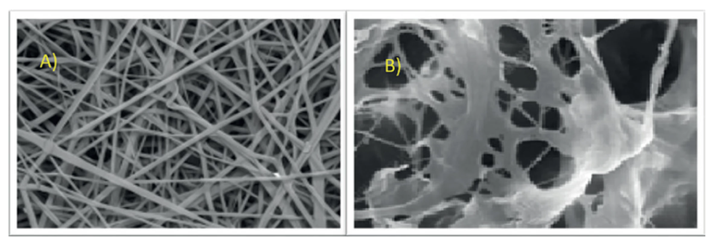 A) Nanovlákna PLA v rastrovacím elektronovém mikroskopu; B) extracelulární dermální matrix v rastrovacím elektronovém
mikroskopu<br>
Fig. 2: A) PLA nanofibres in the scanning electron microscope; B) extracellular dermal matrix in the scanning electron
microscope
