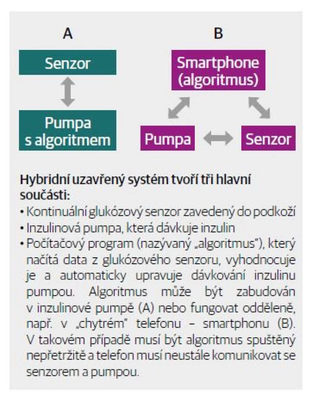 Schematické znázornění součástí uzavřeného
okruhu pro dávkování inzulinu.