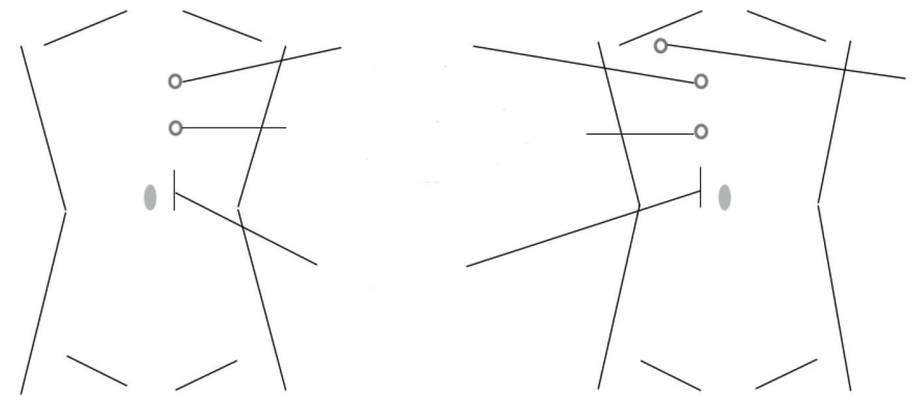 Rozmístění portů pro levou a pravou stranu<br>
Fig. 1. Position of ports for left and right side