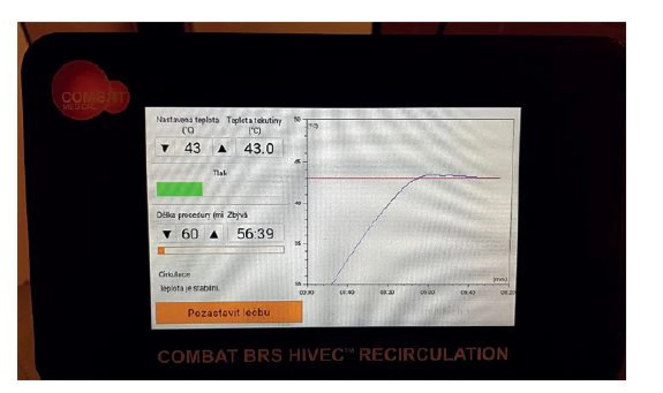 Ovládací rozhraní systému Combat BRS V5<br>
(Foto archiv autora)<br>
Fig. 3: Interface of the Combat BRS V5 system<br>
(Photo: Author‘s archive)
