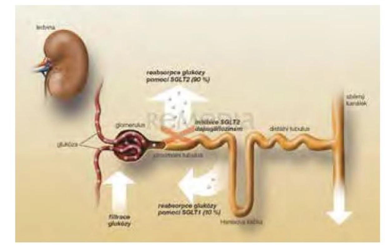 Mechanizmus učinku gliflozinů na receptor SGLT2 v proximálním
tubulu nefronu