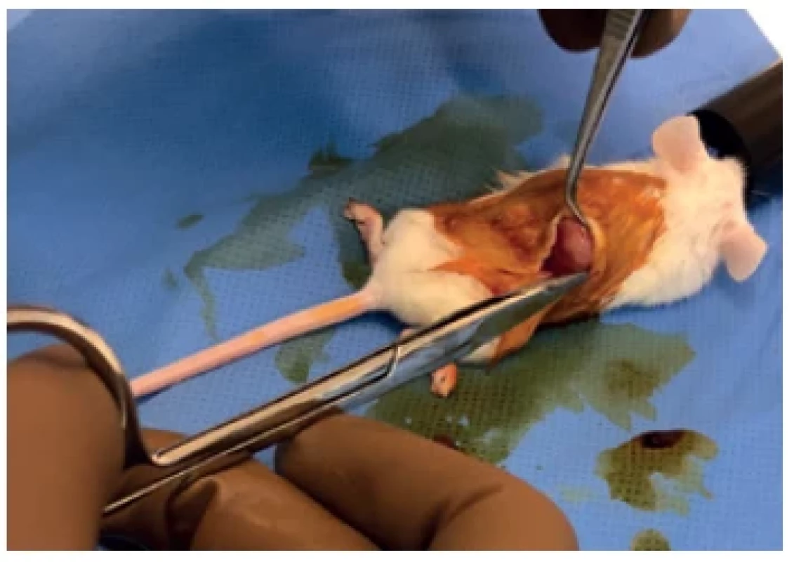 Re-transplantation between generations (NOD/
SCID mouse)