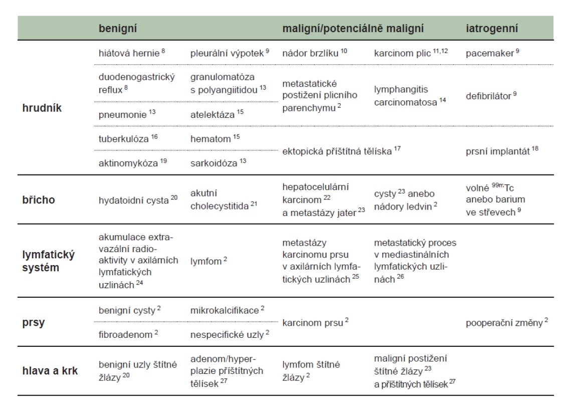 Přehled popsaných příčin nefyziologické (zvýšené anebo snížené) extrakardiální akumulace aktivity podle oblasti.