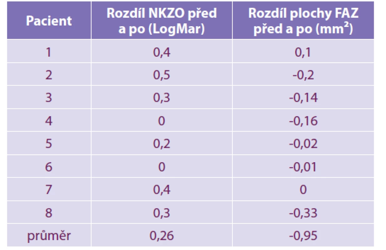 Závislost mezi změnou NKZO a změnou plochy FAZ