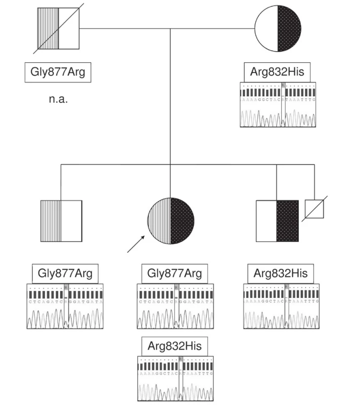 ABCB11 mutations detected in the index patient and
her first-degree relatives. Heterozygosity for the mutation
c.2495G>A (p.Gly877Arg) in one brother and its absence in
the mother indicate paternal origin of this mutation. DNA not
available, n.a. 