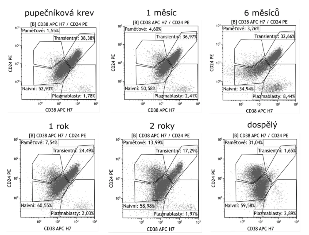 Vývoj zastoupení transientních B lymfocytů v periferní krvi v závislosti na věku<br>
Figure 3. Distribution of transitional B cells in the peripheral blood by age