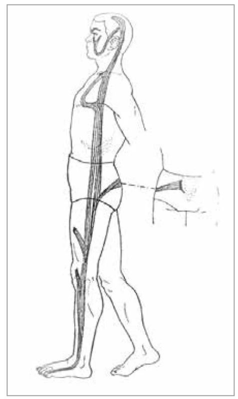 Šľachovo-svalová dráha
žlčníka<br>
Fig. 21. Tendon-muscle path of the
gallbladder