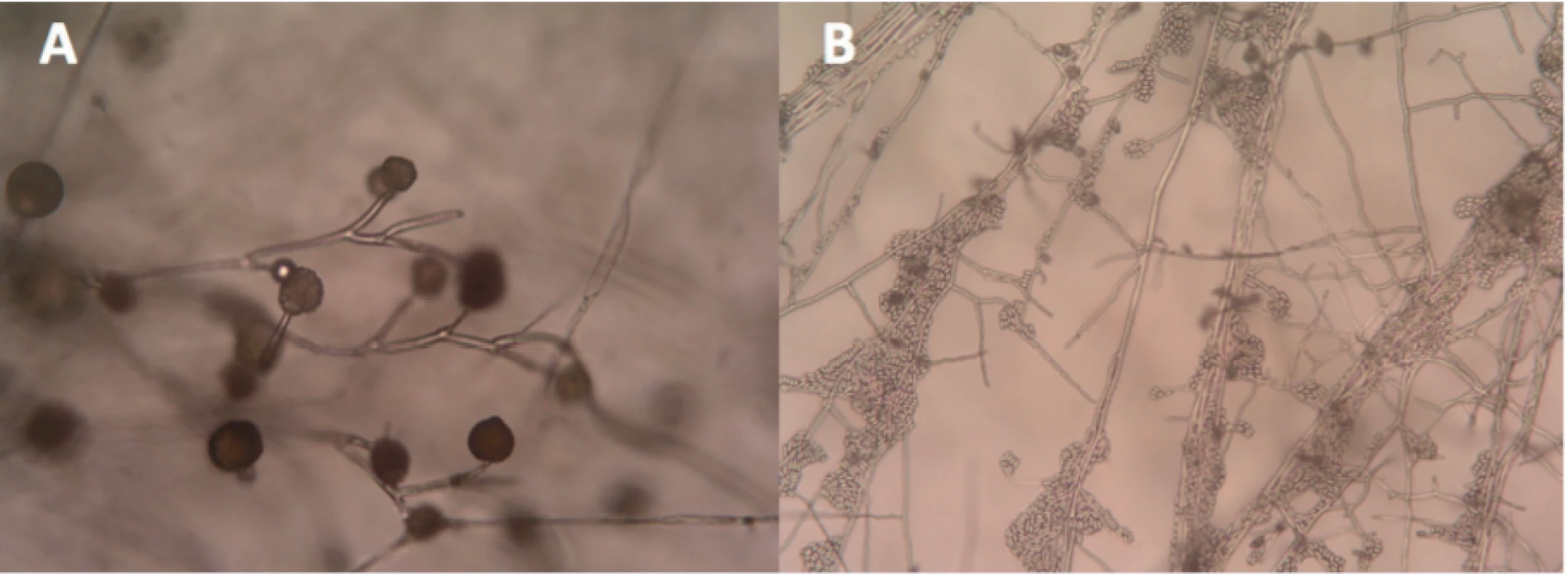A – Mucor circinelloides (left), B – Fusarium sp. (right) both under microscope Enlarged 40x.