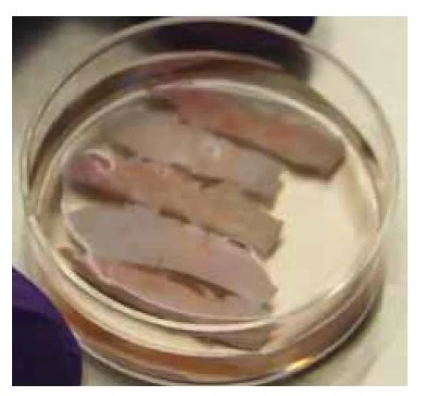 Proužky kortikální tkáně při
procesu kryokonzervace.<br>
Fig. 8. Strips of cortical tissue during
the cryopreservation process.