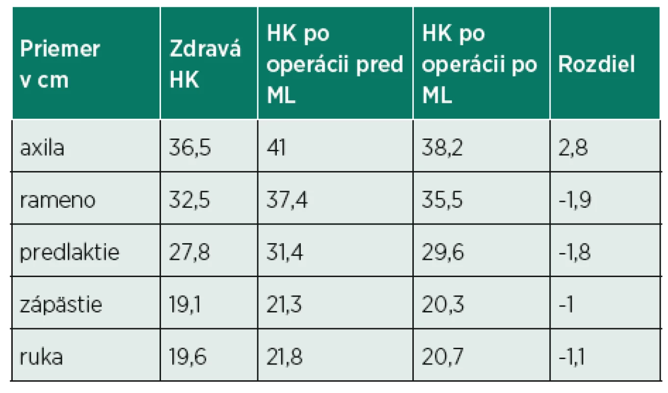 Priemer obvodov zdravej a operovanej hornej končatiny.