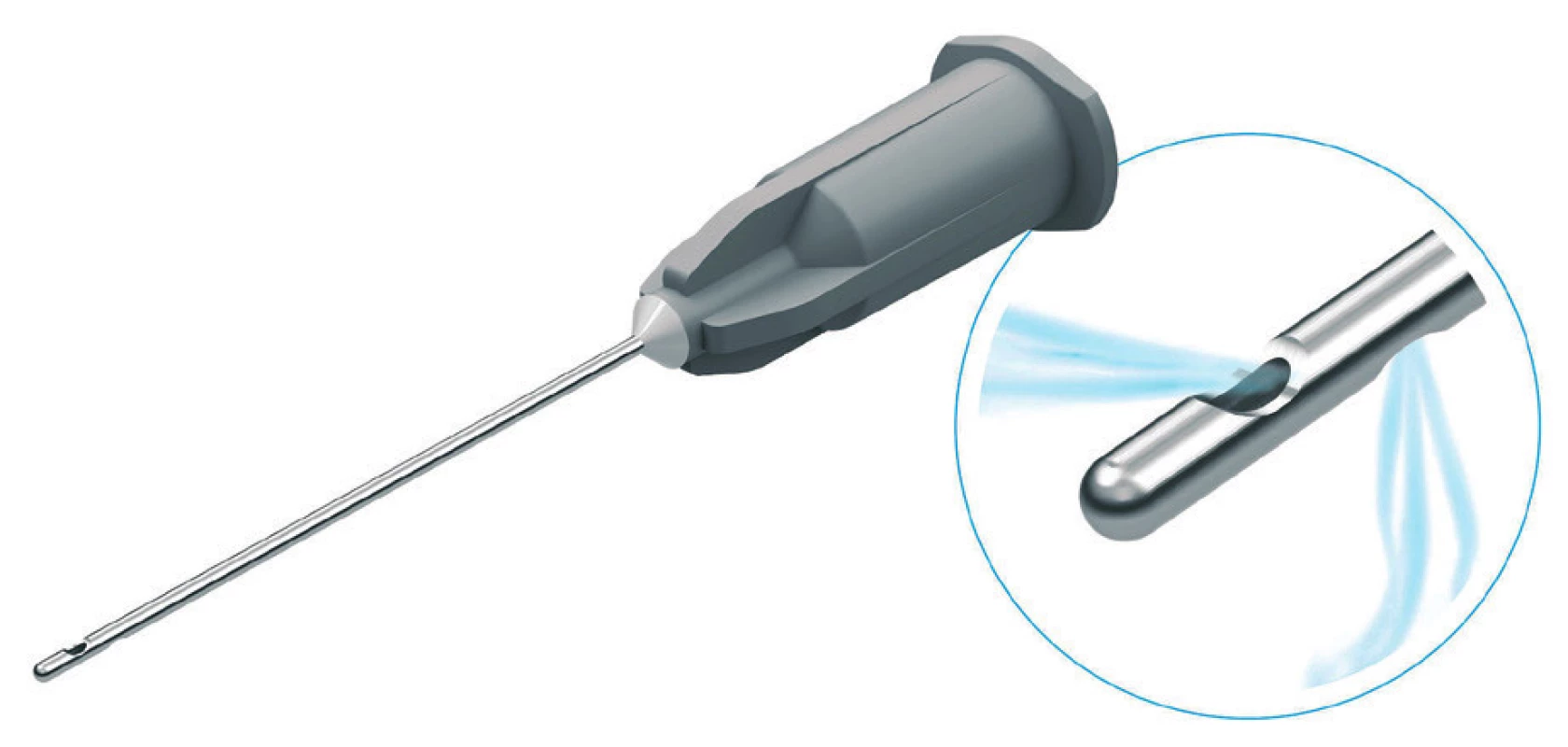 Blunt double side vented irrigation tip cannula for root cannal irrigation during endodontic treatment can be well used for intraluminary application of solutions (Endo/Tech™, Halifax, Canada) Double Side Vented Irrigation Tips [internet] Endo/Tech™, Halifax, Canada [cited 2020 May1] Available from: https://endo-tech-com.3dcartstores.com/Double-Side-Vented-Irrigation-Tips_p_205.html