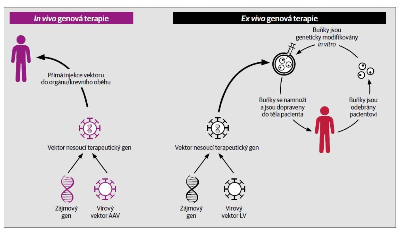In vivo a ex vivo. [Upraveno podle: de Castro MJ, del Toro M, Giugliani R, Couce ML. Gene Therapy for Neuronopathic Mucopolysaccharidoses: State
of the Art. International Journal of Molecular Sciences. 2021;22(17):9200.]