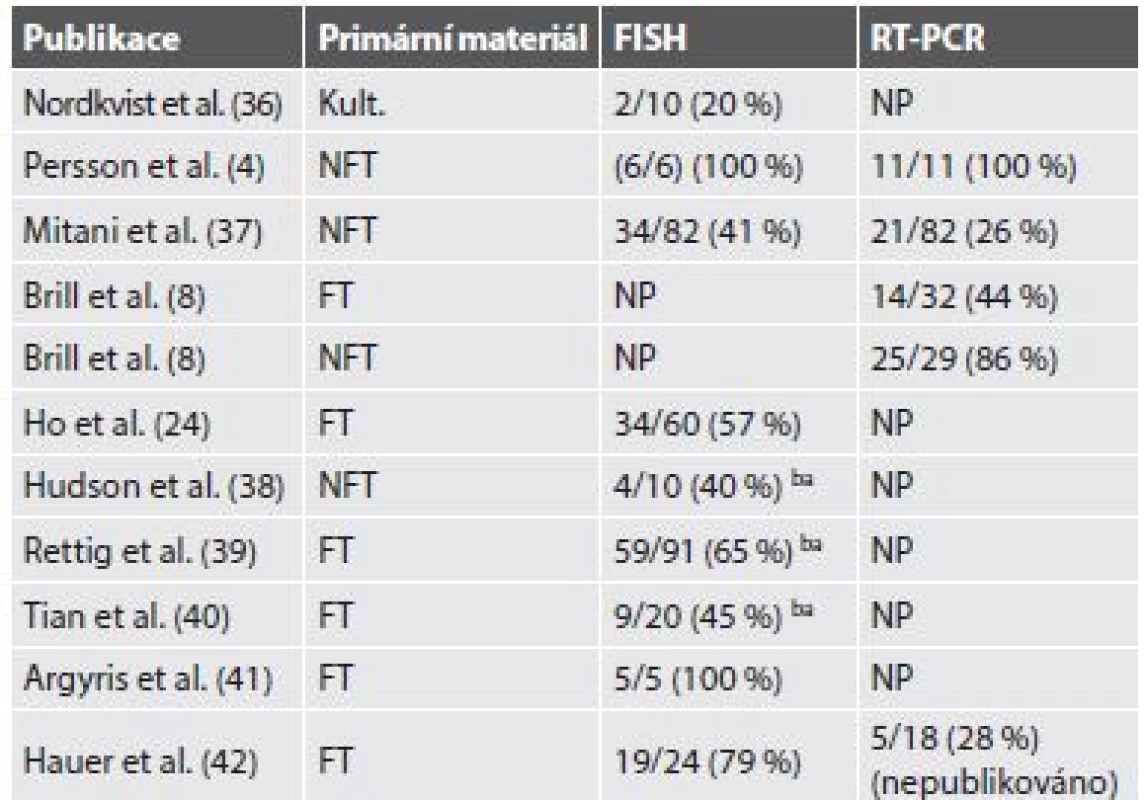 Počty detekovaných fúzí <i>MYB-NFIB</i> v různých studiích použitím
FISH a/nebo pomocí RT-PCR.