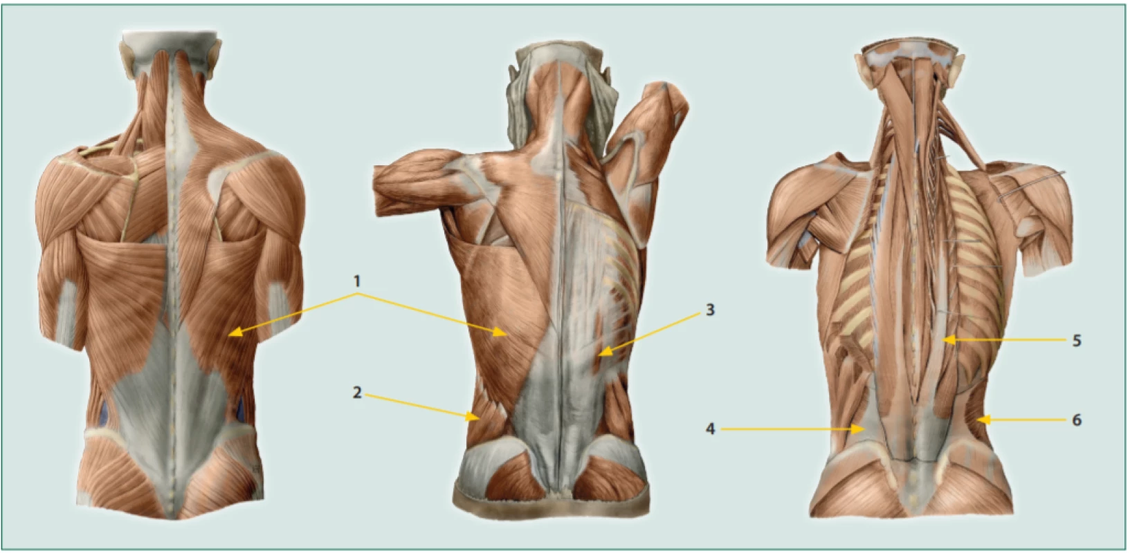 Zádové svaly a thorakolumbální fascie (TLF) 1. m. latissimus dorsi, 2. m. obliguus abdominis externus, 3. m. serratus posterior inferior, 4. fascia
transversalis, 5. m. errector spinae, 6. m. transversus abdominis