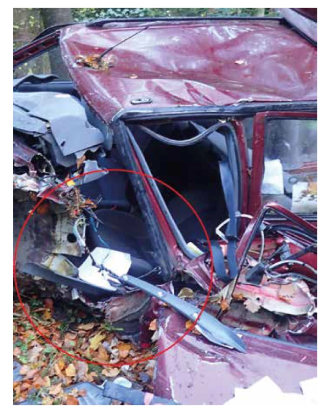Ukázka deformace interiéru vozidla č. 2.<br>
Fig. 7. Illustration of the vehicle no. 2 interior deformation.