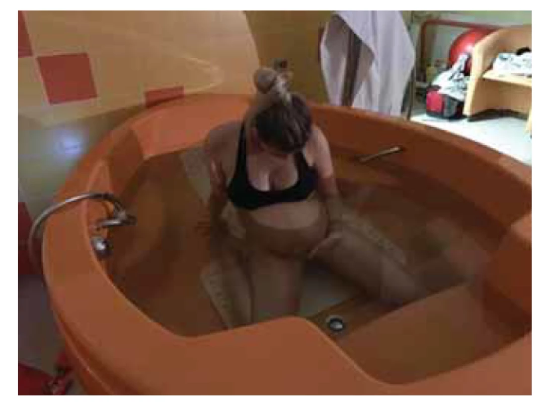 Rodička ve vaně v 1. době porodní. Autorka fotografie 
Bc. Kateřina Konderlová. Foto se souhlasem rodičky.<br>
Fig. 1. First stage of delivery in the water. Photo author Bc.
Kateřina Konderlová. Photo courtesy of mother.