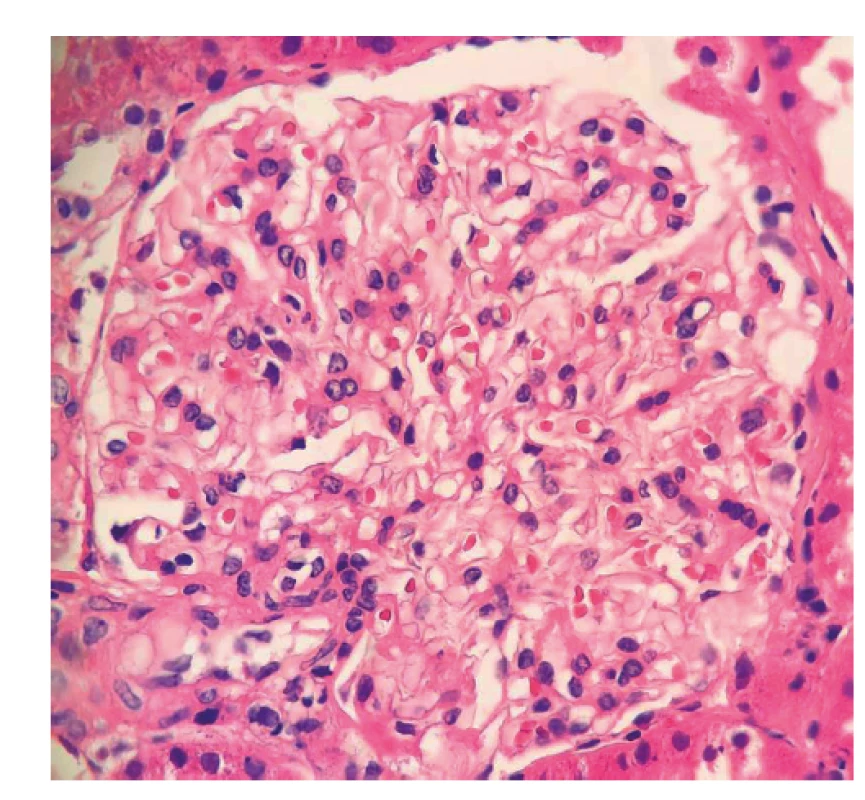 Fotodokumentace první renální biopsie provedené
v roce 2017