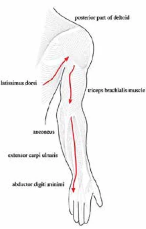 Zadní myofasciální kontinuita horní končetiny. Zdroj: [22]. Fig. 3. Posterior myofascial continuity of the upper limb. Source: [22].