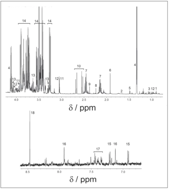 1H-NMR spectrum of cerebrospinal fl uid, cpmg acquisition.
1 – isoleucine; 2 – leucine; 3 – valine; 4 – lactate; 5 – alanine; 6 – acetate; 7 – glutamine;
8 – acetone; 9 – pyruvate; 10 – citrate; 11 – creatine; 12 – creatinine; 13 – myo-inositol;
14 – glucose; 15 – tyrosine; 16 – histidine; 17 – phenylalanine; 18 – formate<br>
Obr. 1. 1H-NMR spektrum v cerebrospinálnom likvore, nábor v pulzovej sekvencii 1H-NMR.
1 – izoleucín; 2 – leucín; 3 – valín; 4 – laktát; 5 – alanín; 6 – acetát; 7 – glutamín; 8 – acetón;
9 – pyruvát; 10 – citrát; 11 – kreatin; 12 – kreatinín; 13 – myo-inozitol; 14 – glukóza; 15 – tyrozín; 16 – histidín; 17 – fenylalanín; 18 – formát