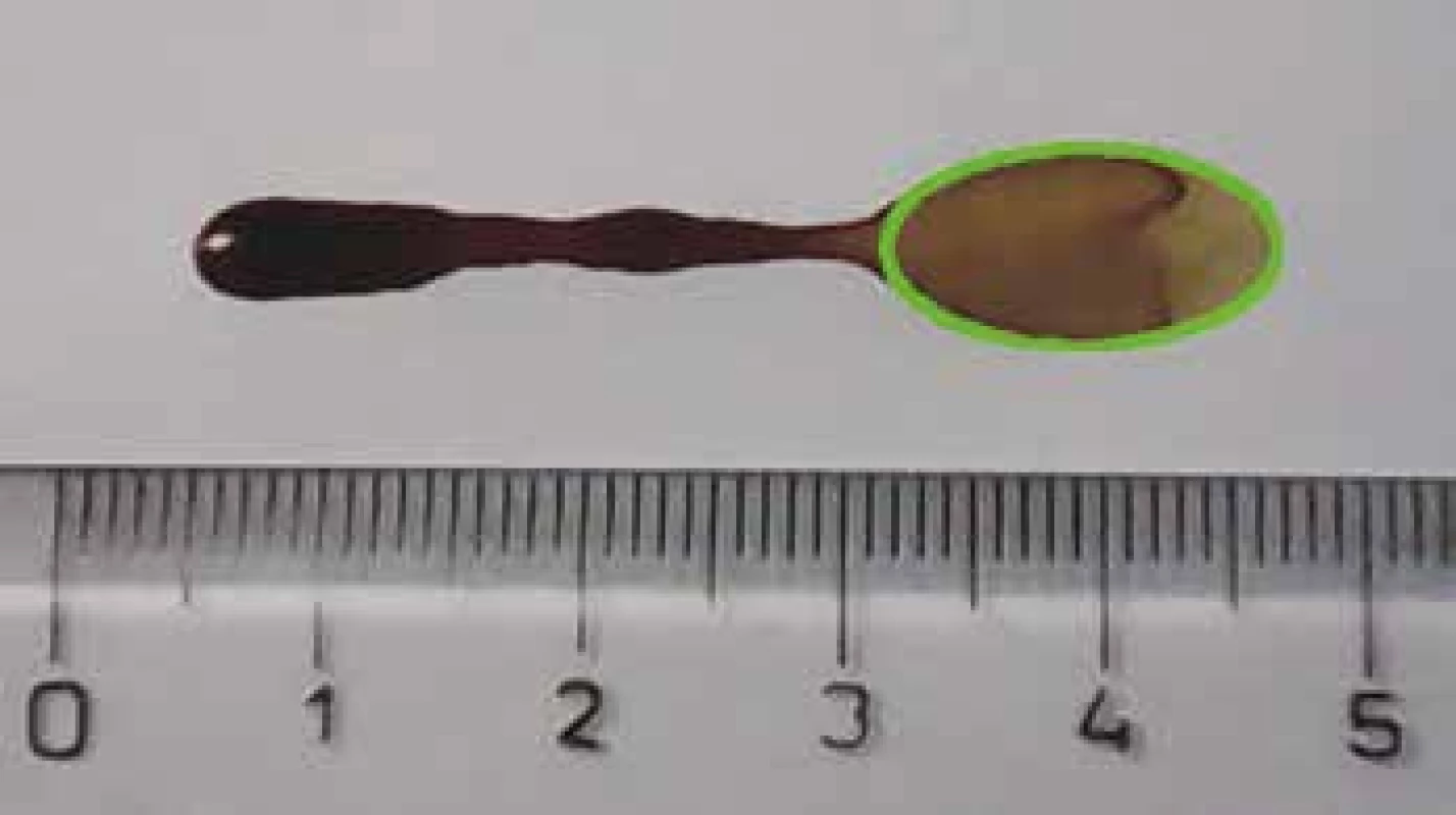 Metoda ellipse fitting. Modelový stříkanec (instantní káva, volný pád
10 cm, úhel dopadu 45°, kancelářský papír) byl vyfotografován. V programu
ImageJ (ver 1.50.i) bylo označeno deset bodů, které by měly tvořit elipsu, ta
pak byla vytvořena funkcí Fit Ellipse. Její poloosy W=7,7 mm a L=15,7 mm,
tedy odhadnutý úhel dopadu je 30°. Ke zvýraznění elipsy obraz upraven
v programu Gimp (ver. 2.8.16).