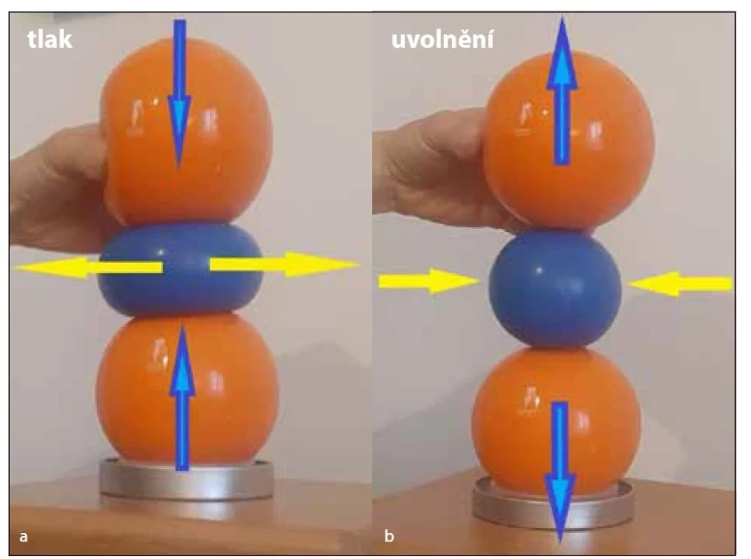 a,b. a) Simulace tlaku obratlů na meziobratlovou ploténku, b) simulace
uvolnění tlaku.<br>
Fig. 3a,b. a) Simulation of vertebral pressure on the intervertebral disc, b) release
simulation.