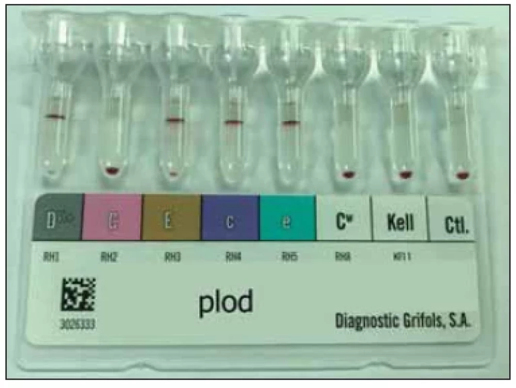 Rh fenotyp plodu (DG Gel Rh Pheno+Kell Grifols).