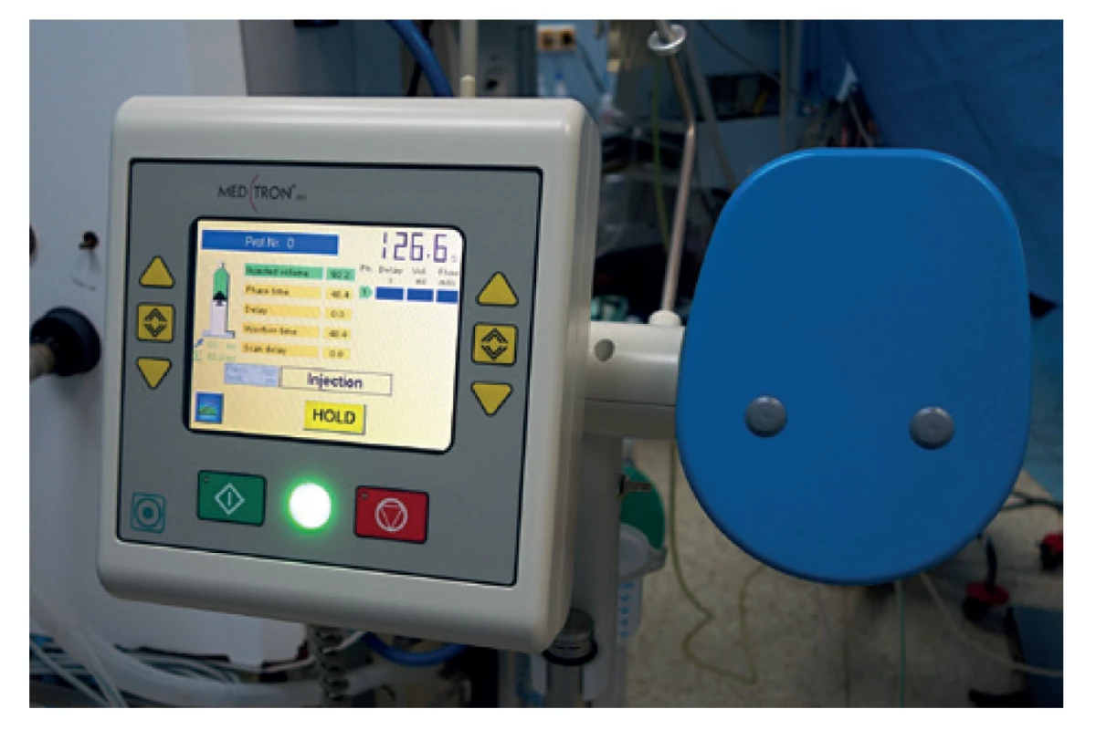 Displej vysokotlaké pumpy<br>
Fig. 5: Display of the high pressure pump
