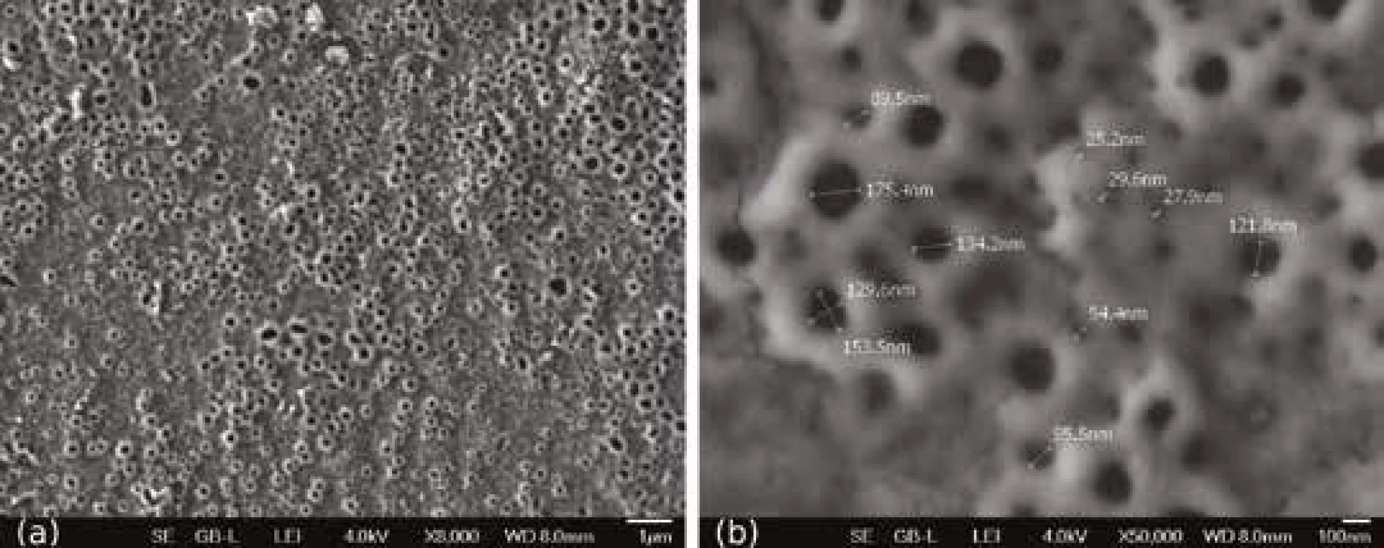 anodizovaného povrchu
vzorků z Ti6Al4V ELI,
přehled (a) a detail
s odměřenými rozměry
pórů (b)<br>
Fig. 2
Nanostructure
of anodized surface
of Ti6Al4V ELI samples,
overview (a) and detail with
measurement of pore sizes (b)