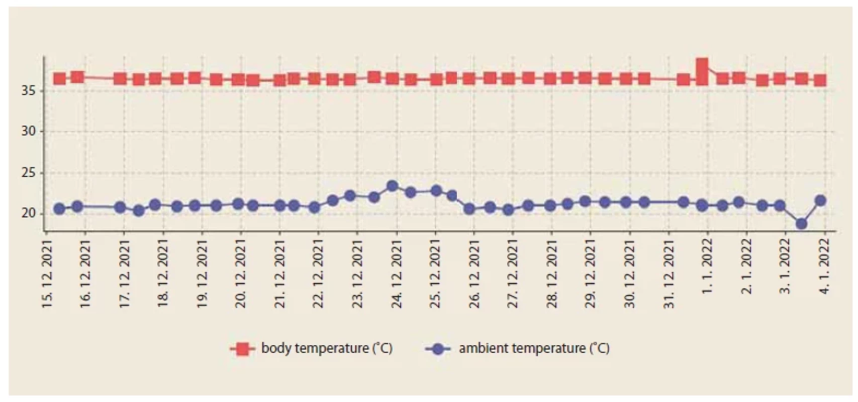 Graph of patient’s temperature aff ecting the decision process in organ allocation [31]. <br> 
Obr. 1. Graf teploty pacienta ovplyvňujúci rozhodovací proces pri prideľovaní orgánov [31].