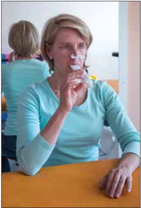 Pacientka dýchá proti odporu dechového trenažéru threshold positive expiratory pressure a snaží se u toho držet
co nejlepší posturální nastavení. Fotografi e byla pořízena s informovaným souhlasem pacientky.<br>
Fig. 3. Patient breathes against the resistance of the threshold positive expiratory pressure device, trying to remain in
the best postural position. The picture
was taken with informed consent from the
patient.