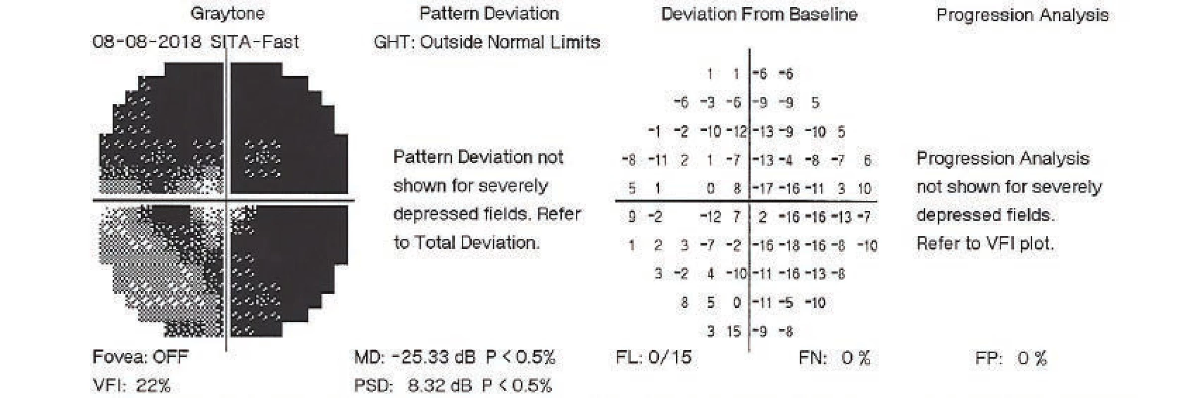Perimetric examination of left eye, 8 August 2018