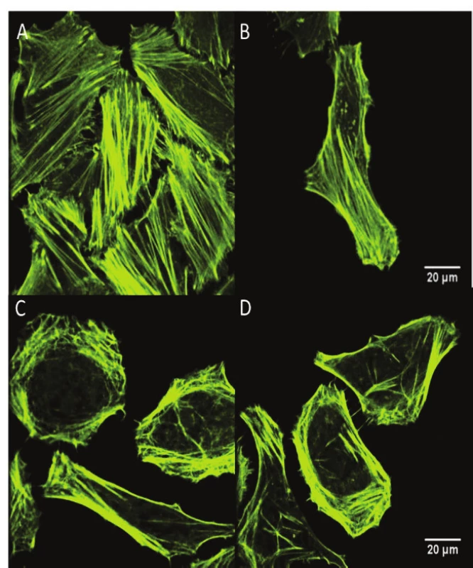 The changes in the cytoskeletal actin structure of
the (A, B) HeLa control cells and (C,D) HeLa cells
exposed to the 5 Jcm-2 ZnPc PDT, evaluation using
fluorescent confocal microscopy. The cells were stained
by Alexa Fluor 532 phalloidin fluorescence probe. The
images showed that 5 Jcm-2 ZnPc PDT on HeLa cells led
to extensive cytoskeletal actin rearrangement and/or its
impairment.