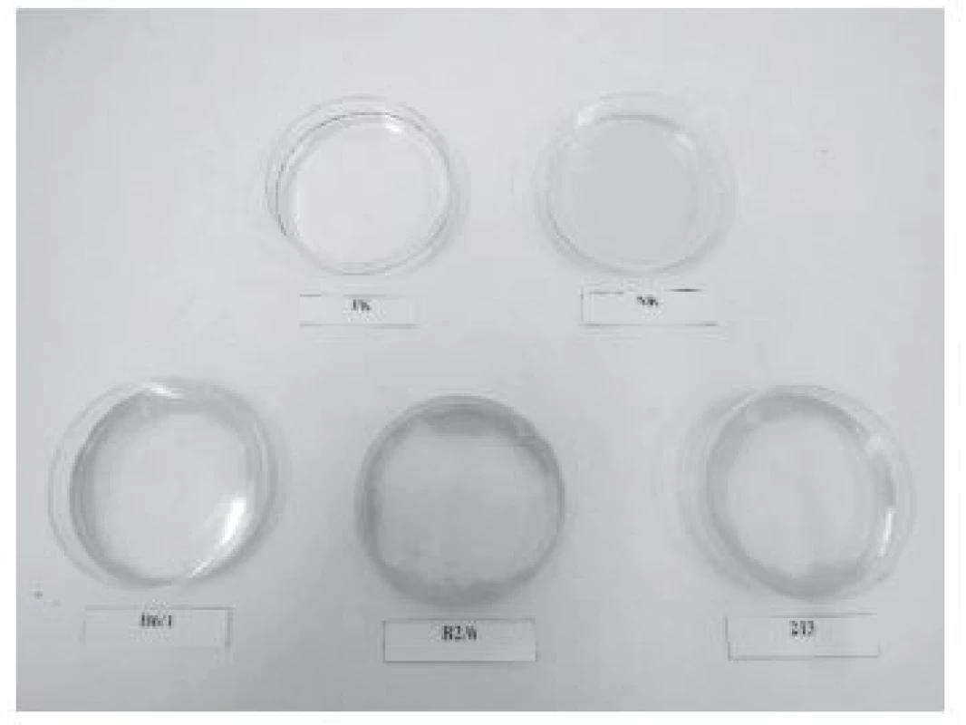 Oil spreading test (tvorba prečistenej zóny)
PK – pozitívna kontrola, NK – negatívna kontrola